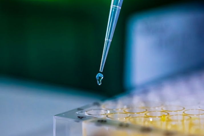 Ҝөзләрин алтындакы шишләрдән хилас олмағын 3 тәсирли үсулу