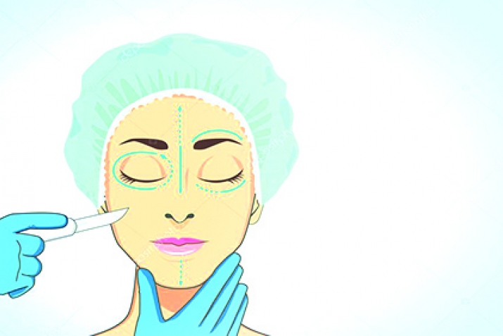 Хъсан тахьай пластика