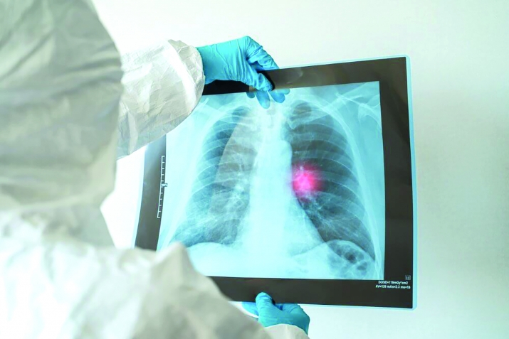 Коронавирусдин судур