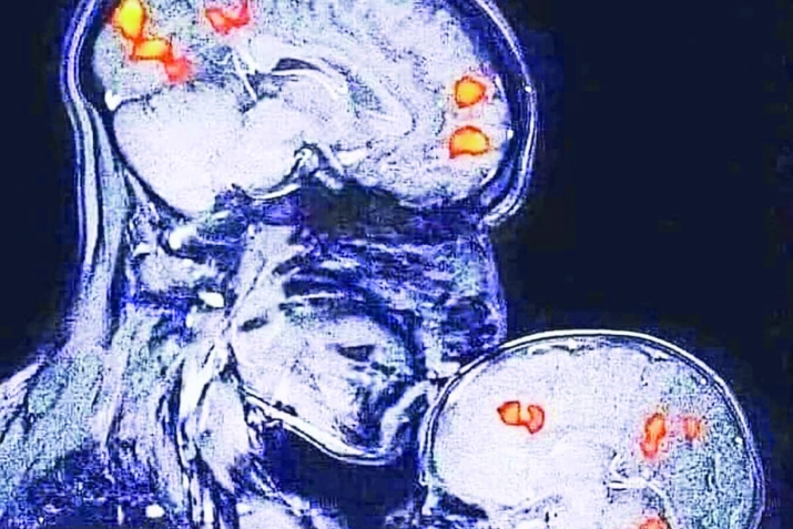 Балаларыгызны ешрак сөегез