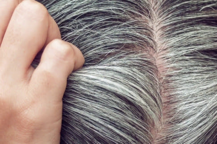 Everything you need to know about gray hair