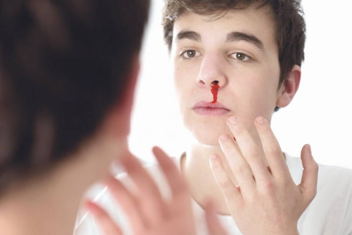 Чаро аз бинӣ хун меравад?