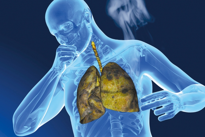 ГьикI вейпри жаванар рекьизва?