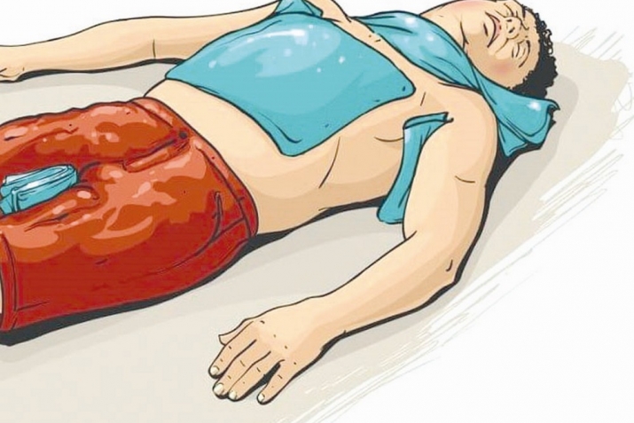 Ёрии таъҷилӣ ба шахси офтобзада