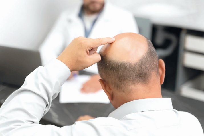 Тирамоҳ. Чаро мӯйи сар мерезад?