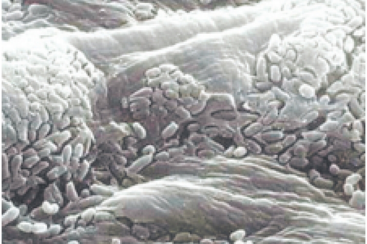 Billions of germs on our skin